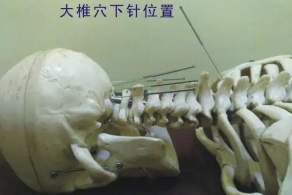 八字疗法图