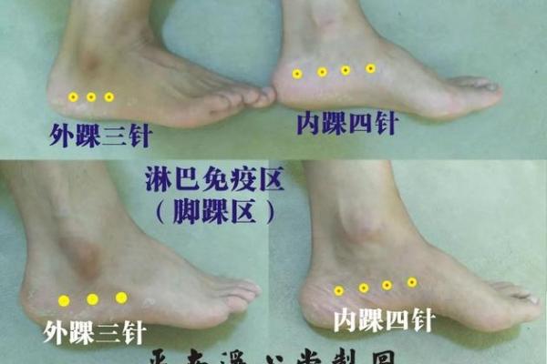 八字疗法图