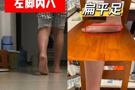 八字腿图片