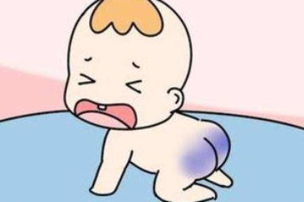 算命胎记