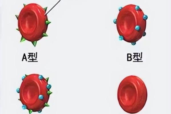 血型决定寿命长短？美国60万人研究发现：A型血60岁前或更易中风