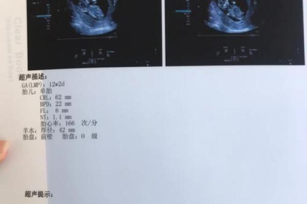 算命说打过胎实际没有胎心