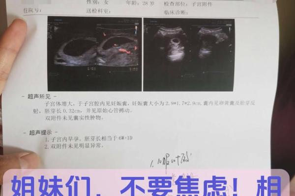 算命说打过胎实际没有胎心