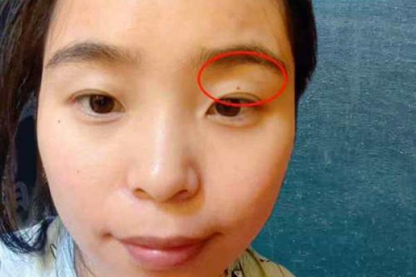 面相额头 女人额头高算命