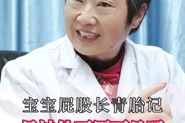 屁股有胎记算命分析