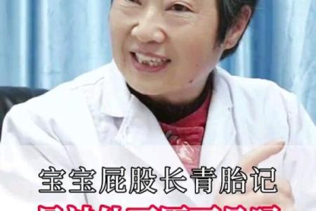 屁股有胎记算命分析