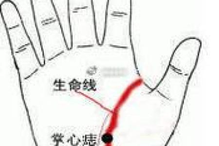 男手痣相图解算命