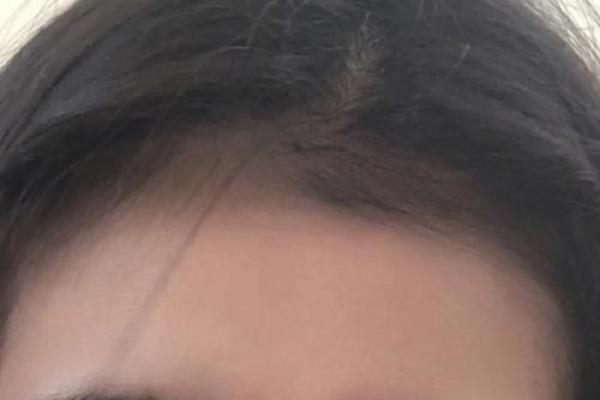 风水额头窄的男人是穷命