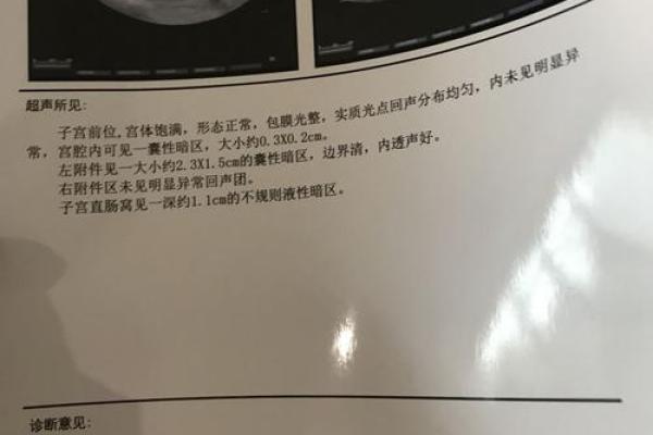 算命的算出宫外孕