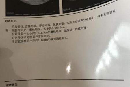 算命的算出宫外孕