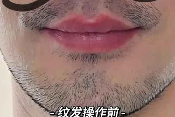 人中八字型 人中八字型