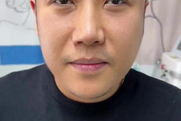 皱眉八字 皱眉八字