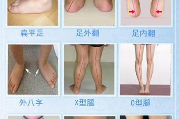 内八字外八字 内八字外八字