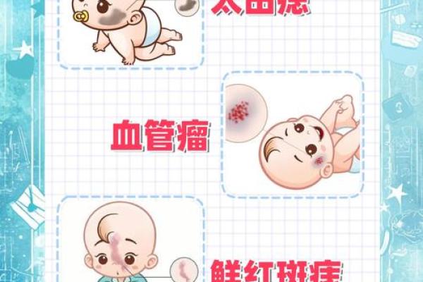 面部上的胎记算命分析 面部上的胎记算命分析