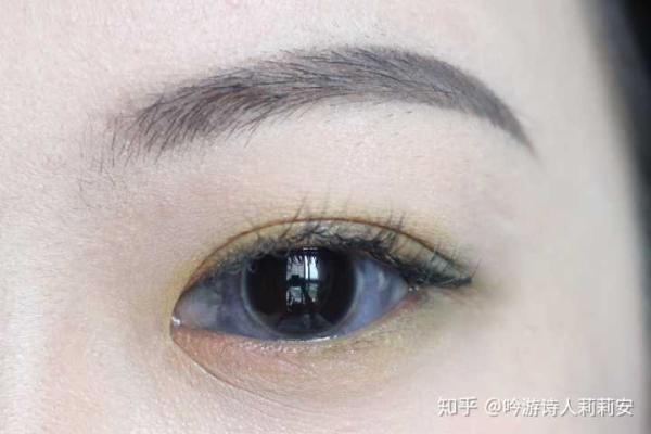 眼睛上的胎记算命分析