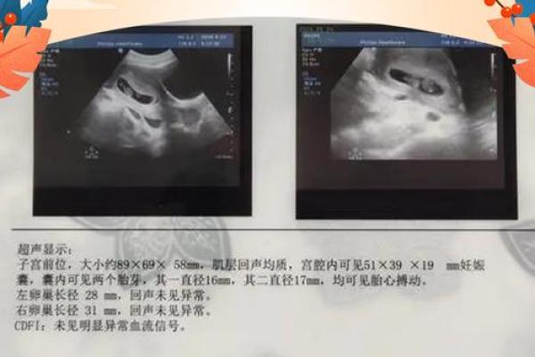 紫薇斗数怀孕迹象 紫薇斗数怀孕迹象