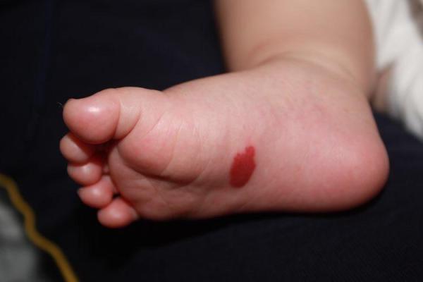 脚底的胎记算命分析