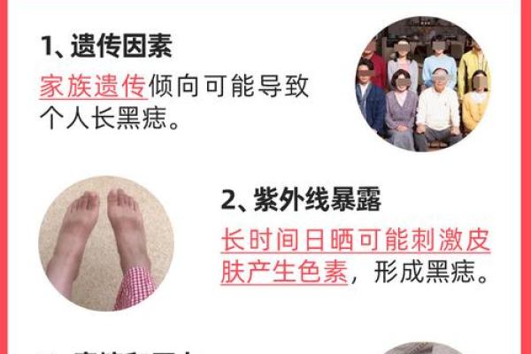脚底的胎记算命分析