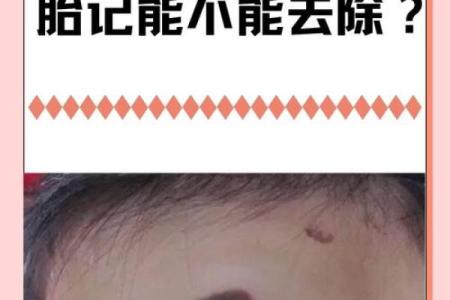 男婴眉心长“月牙”胎记，母亲带他算命后神秘失踪，至今下落不明