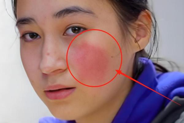 胎记位置算命看运势 胎记位置算命看运势