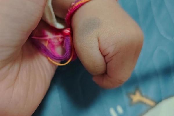 手上胎记算命图解