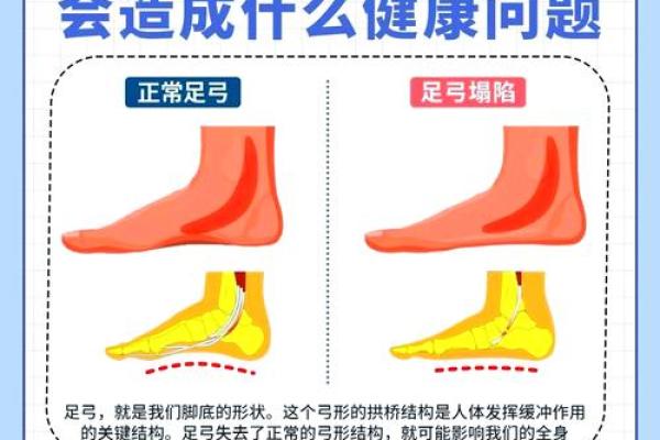 如何纠正内八字脚