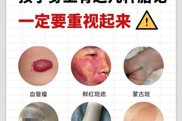 额头胎记算命有哪些影响-