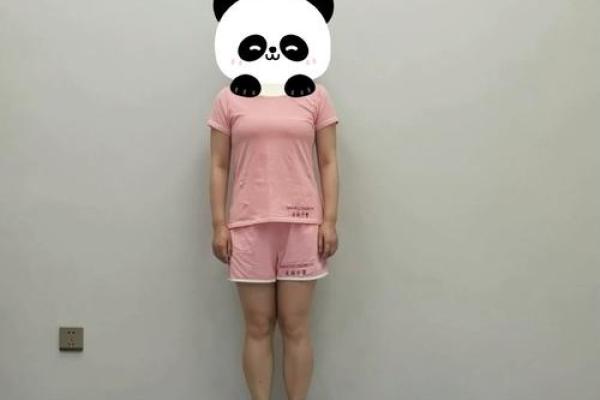 怎样纠正内八字,14岁内八字怎么矫正最快 怎样纠正内八字,14岁内八字怎么矫正最快