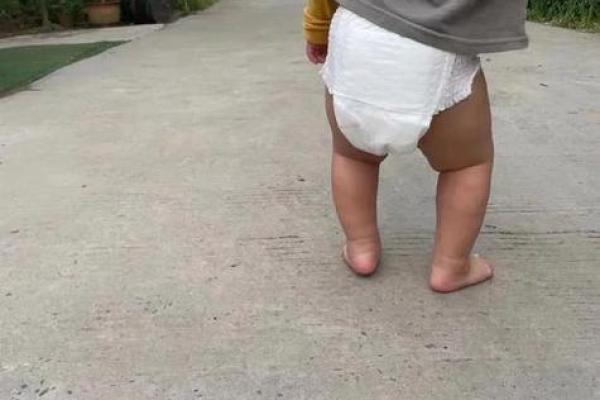 小腿内八字 小腿内八字