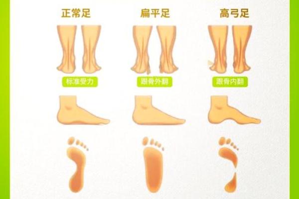 小腿内八字 小腿内八字