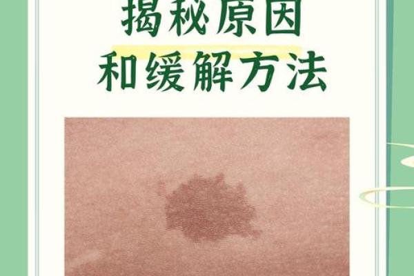 背部胎记算命,背部有胎记会怎样 背部胎记算命,背部有胎记会怎样