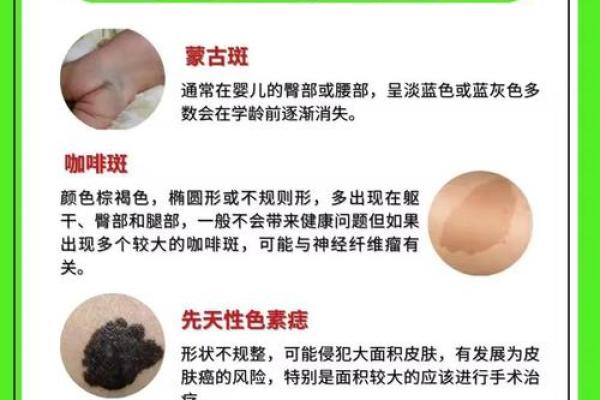 背部胎记算命,背部有胎记会怎样 背部胎记算命,背部有胎记会怎样