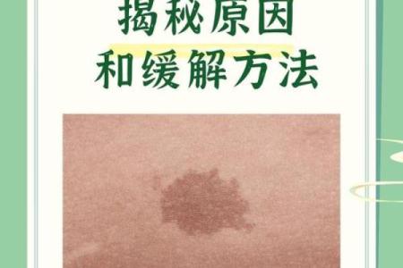 背部胎记算命，背部有胎记会怎样