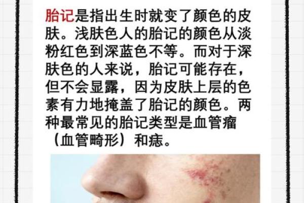 看胎记颜色类型算命