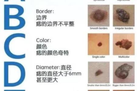 看胎记颜色类型算命